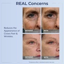 plexaderm-rapid-reduction-eye-serum---vi-5.jpg
